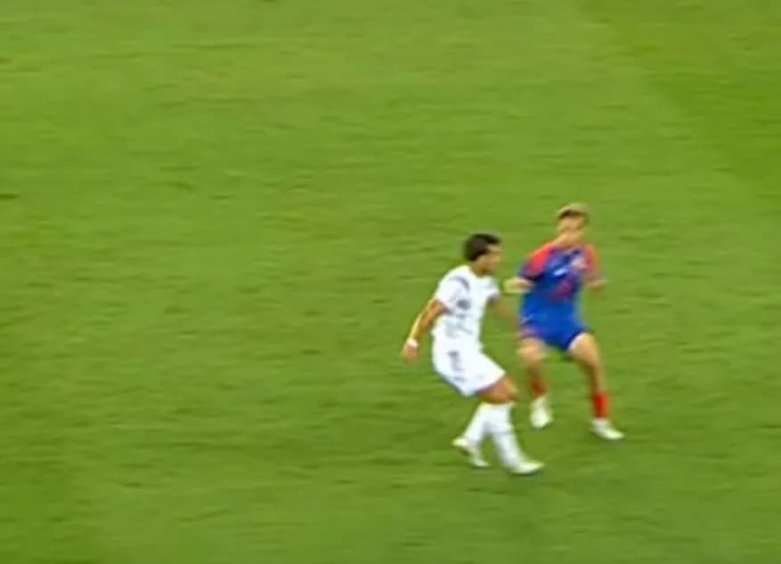 U duk si lëndim joserioz, por futbollisti shqiptar ka pësuar frakturë të katërfishtë nga kjo goditje në Zvicër