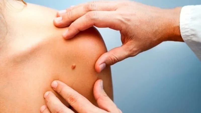 9 simptomat e kancerit që nuk duhet t’i injoroni