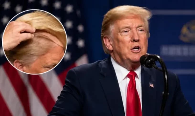 U përfol se presidenti amerikan mban paruke, Trump i përgjigjet komenteve: Era do të ma kishte marrë deri tash