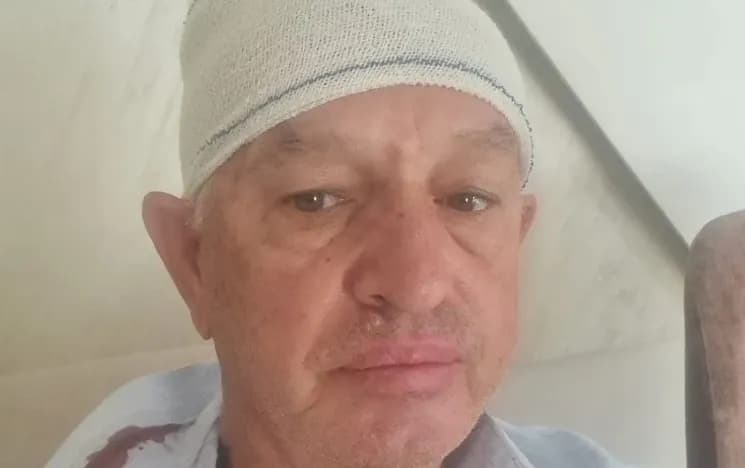 Invalidi i UÇK-së përfundoi me tetë qepje në kokë në emergjencë