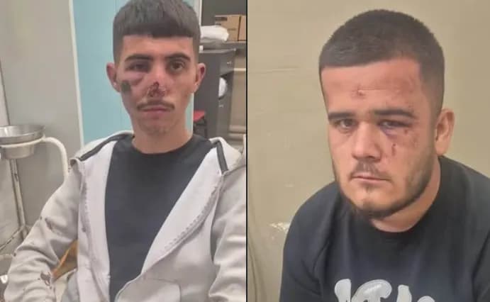 Ngjarje e rëndë në Shkup, dy të rinj dyshohet se u rrahën brutalisht nga Policia