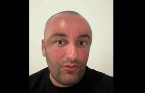 Samedi i “It’s My Home” denoncon publikisht, shfaqet i “stërkuqur” nga botoxi në Kosovë