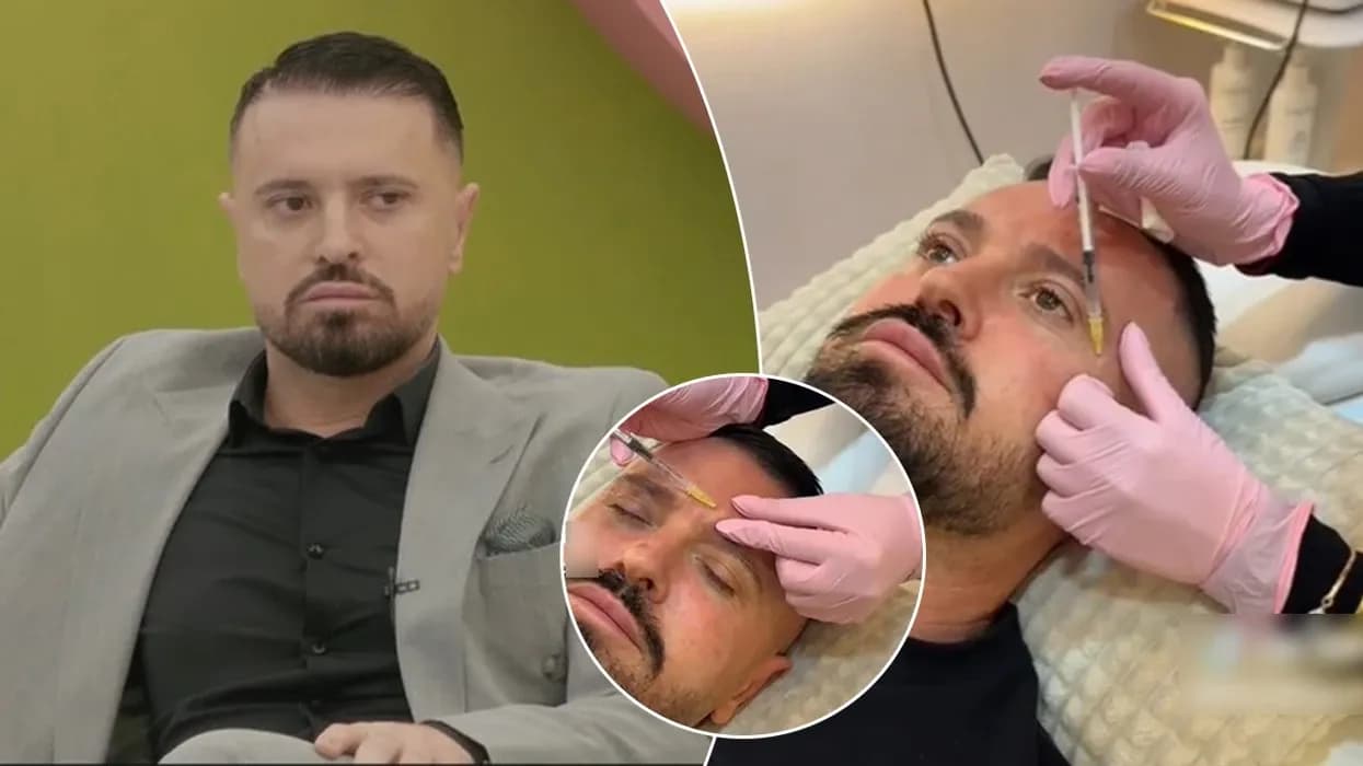 Publikohen pamjet e Labinot Rexhës duke injektuar botoks në fytyrë para se të hynte në Big Brother VIP Kosova 4