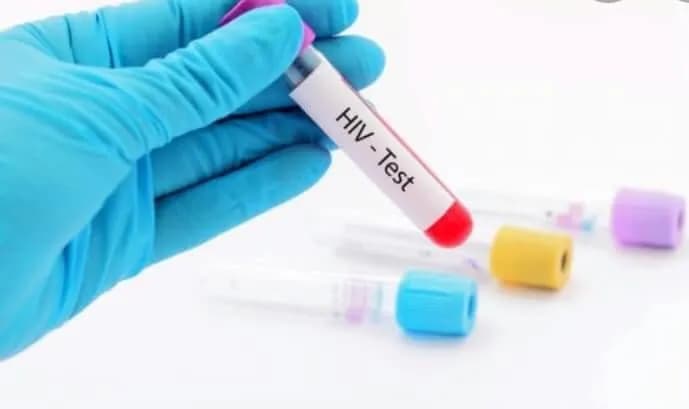 Në rritje numri i rasteve me HIV AIDS në Kosovë, Nuhiu: ka njerëz që nuk e dinë që ekziston sëmundja